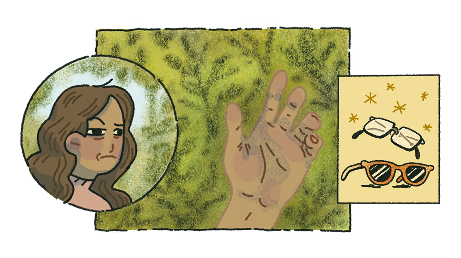 miopía y astigmatismo